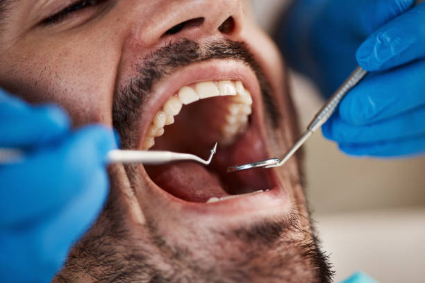 Best Emergency Broken Tooth Repair in Tashua, CT